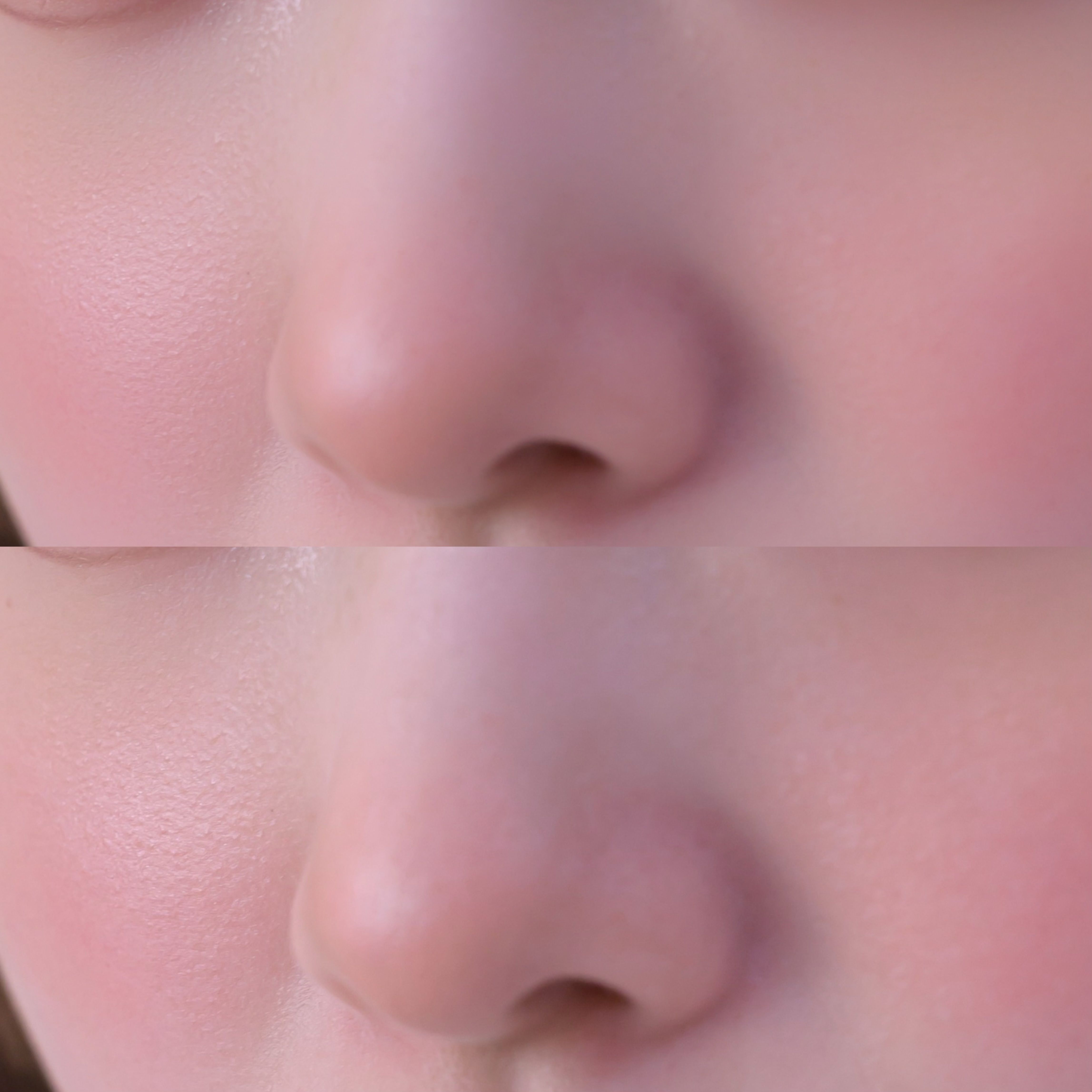 Image in a image block